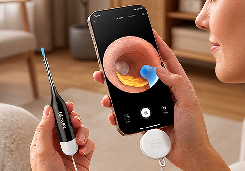 2026 MUSE Design Awards Winner - Visual Ear Cleaner Xlife 3 by Heifeng Zhizao (Shenzhen) Technology Co., Ltd